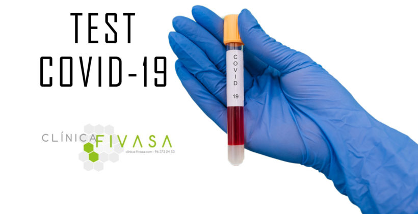 Todo lo que necesitas saber sobre el test del COVID-19