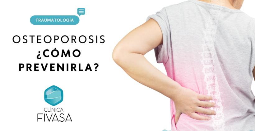 Cómo prevenir la aparición de la Osteoporosis