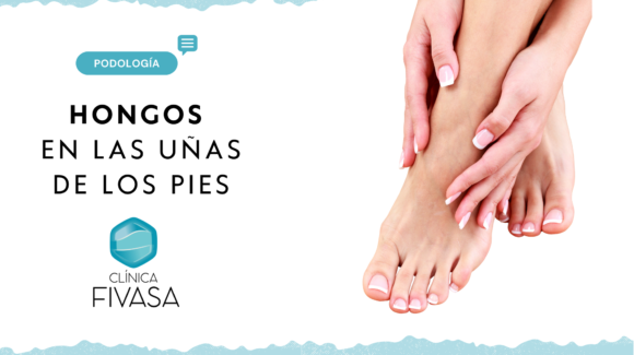 Hongos en las uñas de los pies, qué son y cómo tratarlos