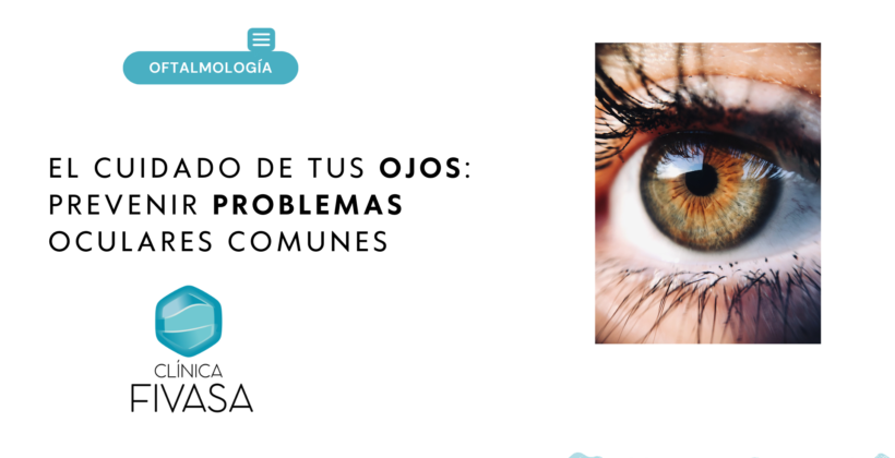 El cuidado de tus ojos: Prevenir problemas oculares comunes
